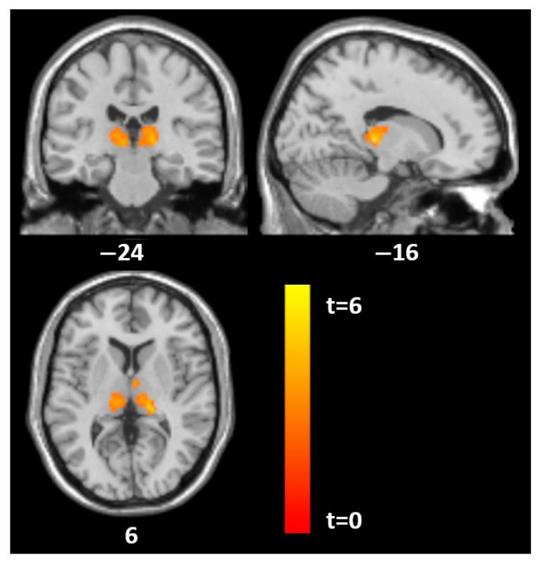 https://cdn.ncbi.nlm.nih.gov/pmc/blobs/de1d/12347840/4b1c534bde83/jcm-14-05438-g002.jpg