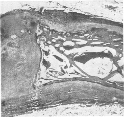 https://cdn.ncbi.nlm.nih.gov/pmc/blobs/de22/499569/c4d7d447dfda/jnnpsyc00308-0039-c.jpg
