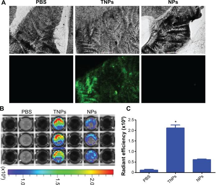 https://cdn.ncbi.nlm.nih.gov/pmc/blobs/de25/4235507/0222368682dc/ijn-9-5261Fig3.jpg