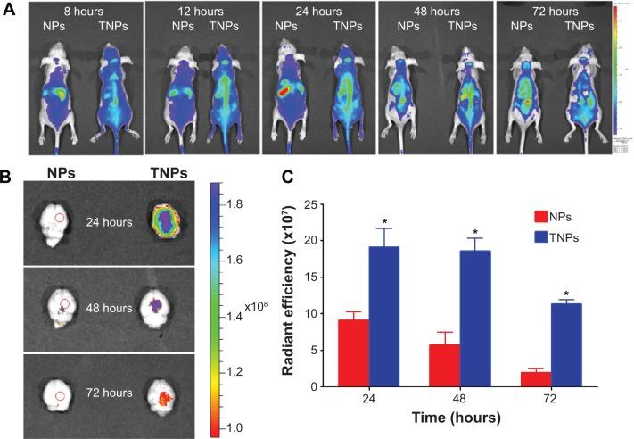 https://cdn.ncbi.nlm.nih.gov/pmc/blobs/de25/4235507/589be4c38b15/ijn-9-5261Fig4.jpg