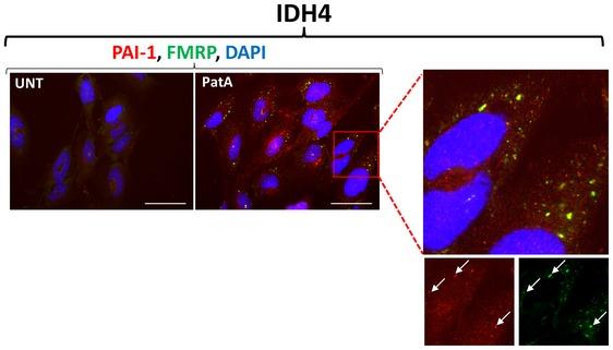 https://cdn.ncbi.nlm.nih.gov/pmc/blobs/de25/5934773/bb6cbd05e059/EMBR-19-e44722-g005.jpg