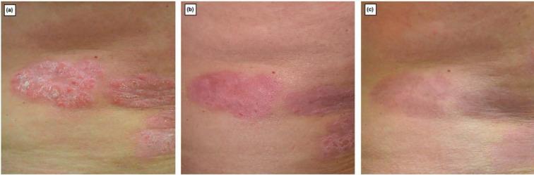 https://cdn.ncbi.nlm.nih.gov/pmc/blobs/de30/9464281/40ab0e8658de/13555_2022_792_Fig2_HTML.jpg