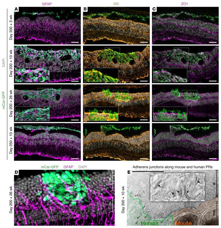https://cdn.ncbi.nlm.nih.gov/pmc/blobs/de37/9197520/076e0f6b37c4/jci-132-154619-g071.jpg