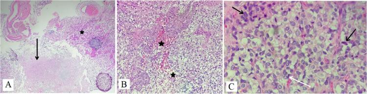 https://cdn.ncbi.nlm.nih.gov/pmc/blobs/de39/10238590/3b4fffc3e025/gr2.jpg