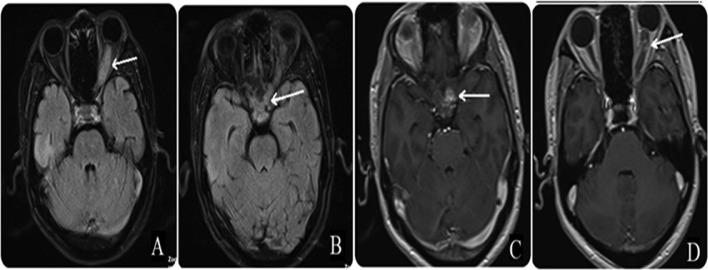 https://cdn.ncbi.nlm.nih.gov/pmc/blobs/de39/10238590/7e5166a88b52/gr3.jpg
