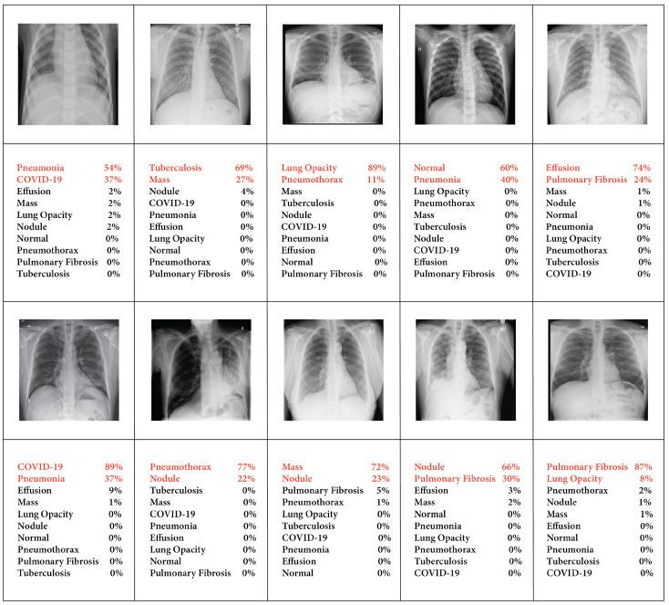https://cdn.ncbi.nlm.nih.gov/pmc/blobs/de3b/11086108/7ab027eb48c4/sensors-24-02830-g015.jpg