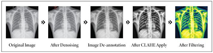 https://cdn.ncbi.nlm.nih.gov/pmc/blobs/de3b/11086108/98a9be923a86/sensors-24-02830-g007.jpg