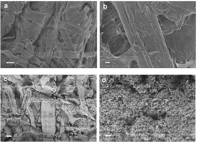 https://cdn.ncbi.nlm.nih.gov/pmc/blobs/de3d/5465062/7c1666fcbe8e/41598_2017_3265_Fig7_HTML.jpg