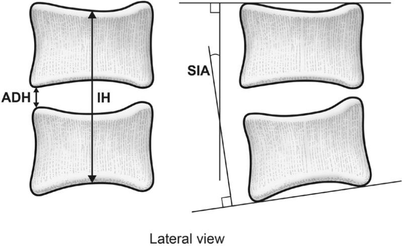 https://cdn.ncbi.nlm.nih.gov/pmc/blobs/de3e/3941725/a66c8b656798/kjs-10-72-g001.jpg
