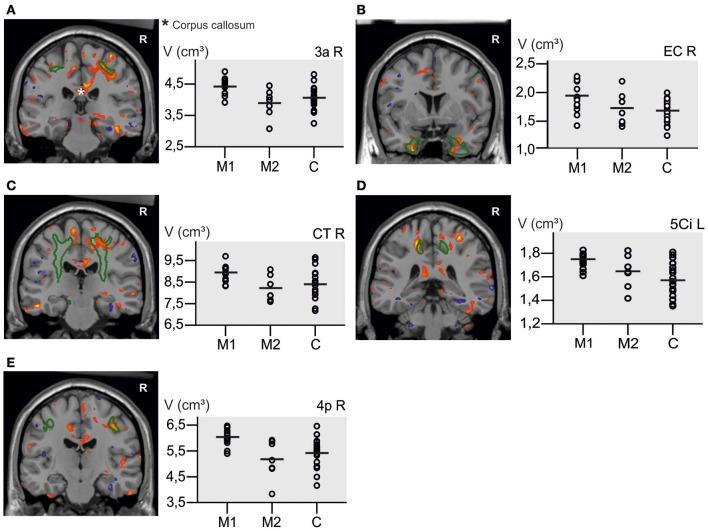 https://cdn.ncbi.nlm.nih.gov/pmc/blobs/de4d/3779931/4845334f332e/fpsyg-04-00636-g0005.jpg