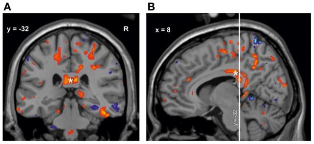 https://cdn.ncbi.nlm.nih.gov/pmc/blobs/de4d/3779931/8313631a2a8f/fpsyg-04-00636-g0004.jpg