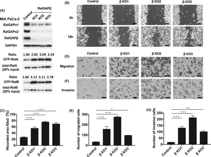 https://cdn.ncbi.nlm.nih.gov/pmc/blobs/de4e/8353909/4e8c999ab13e/CAS-112-3064-g006.jpg