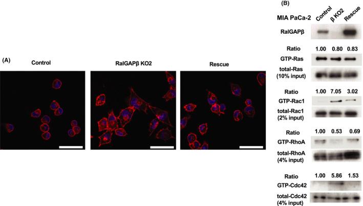 https://cdn.ncbi.nlm.nih.gov/pmc/blobs/de4e/8353909/4f0fd525f7f0/CAS-112-3064-g003.jpg