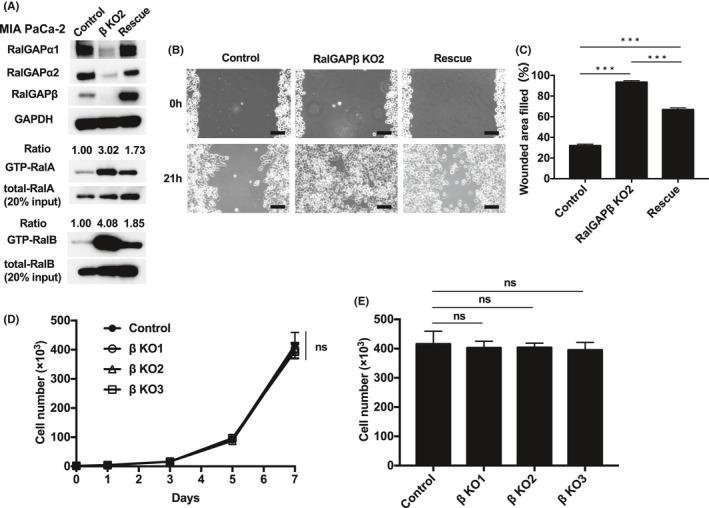 https://cdn.ncbi.nlm.nih.gov/pmc/blobs/de4e/8353909/aa7537ee176a/CAS-112-3064-g002.jpg