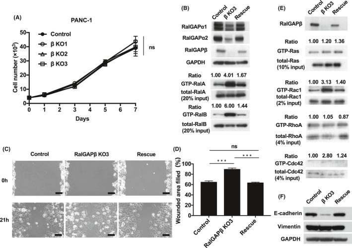 https://cdn.ncbi.nlm.nih.gov/pmc/blobs/de4e/8353909/ef62d9db74bd/CAS-112-3064-g001.jpg