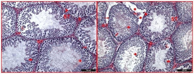 https://cdn.ncbi.nlm.nih.gov/pmc/blobs/de4f/11407361/71778de51661/tjmed-54-04-858f5.jpg