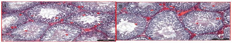 https://cdn.ncbi.nlm.nih.gov/pmc/blobs/de4f/11407361/c70abf2454f0/tjmed-54-04-858f3.jpg