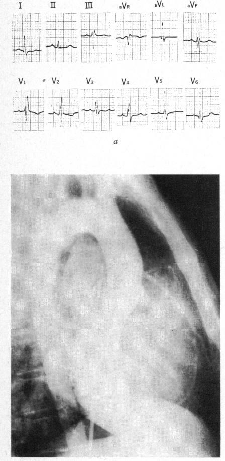 https://cdn.ncbi.nlm.nih.gov/pmc/blobs/de5a/484103/0d186d6cad92/brheartj00252-0110-a.jpg