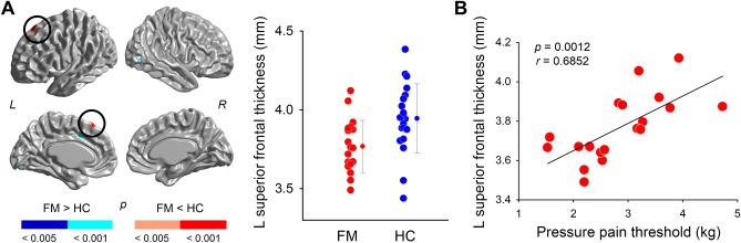 https://cdn.ncbi.nlm.nih.gov/pmc/blobs/de5c/8640058/a8ffb89f504b/41598_2021_2616_Fig2_HTML.jpg
