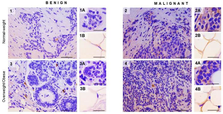 https://cdn.ncbi.nlm.nih.gov/pmc/blobs/de65/8198826/4eb74a6fb924/cancers-13-02731-g004.jpg