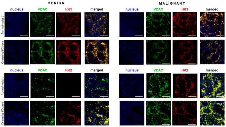 https://cdn.ncbi.nlm.nih.gov/pmc/blobs/de65/8198826/ef9e4b140a8c/cancers-13-02731-g005.jpg