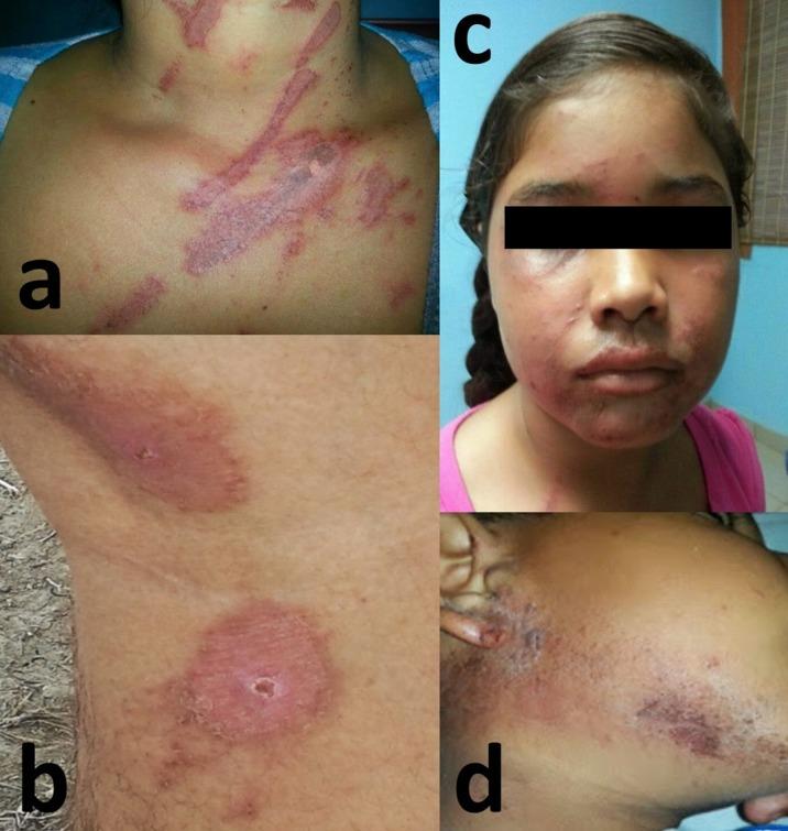 https://cdn.ncbi.nlm.nih.gov/pmc/blobs/de6f/5429145/37e453a5cc54/cureus-0009-00000001158-i03.jpg