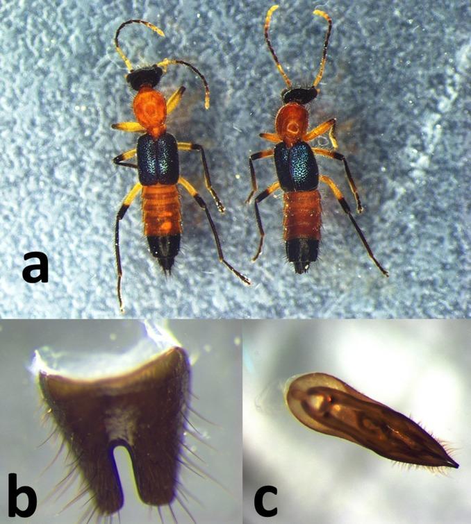 https://cdn.ncbi.nlm.nih.gov/pmc/blobs/de6f/5429145/f5c15c32bc67/cureus-0009-00000001158-i04.jpg