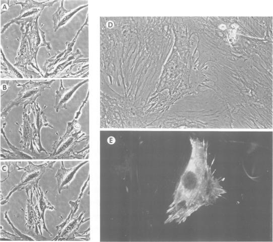 https://cdn.ncbi.nlm.nih.gov/pmc/blobs/de70/452816/b714bf9744d4/emboj00104-0220-a.jpg