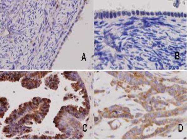https://cdn.ncbi.nlm.nih.gov/pmc/blobs/de71/2383925/9934db6a4e55/1476-4598-7-35-7.jpg