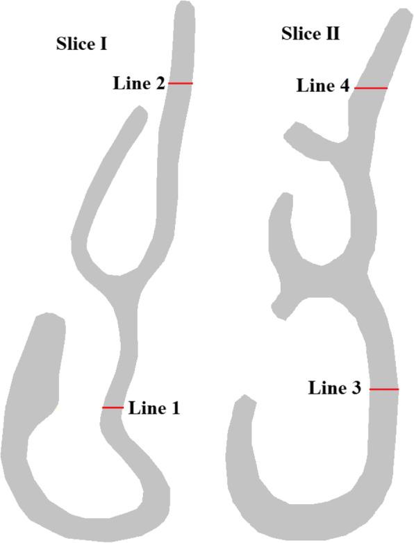 https://cdn.ncbi.nlm.nih.gov/pmc/blobs/de74/7789411/ce26776ceb9e/12976_2020_133_Fig3_HTML.jpg