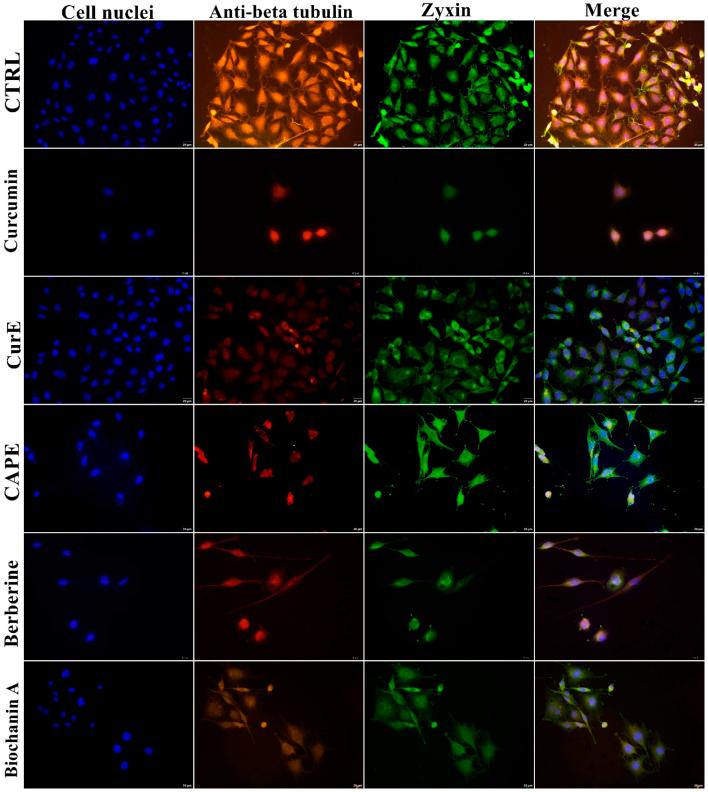 https://cdn.ncbi.nlm.nih.gov/pmc/blobs/de75/11701009/1647dc9711b4/fcell-12-1476007-g013.jpg
