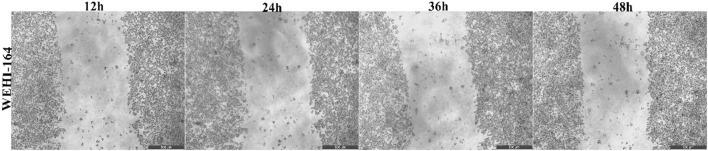 https://cdn.ncbi.nlm.nih.gov/pmc/blobs/de75/11701009/6c7a8b2fe8f4/fcell-12-1476007-g019.jpg