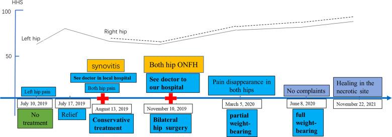 https://cdn.ncbi.nlm.nih.gov/pmc/blobs/de76/9608540/3f63a99cda31/fsurg-09-944480-g004.jpg