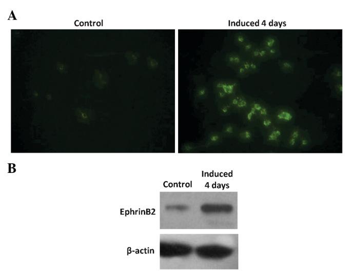 https://cdn.ncbi.nlm.nih.gov/pmc/blobs/de77/3860981/d80b9ba9a7b7/ETM-07-01-0080-g01.jpg