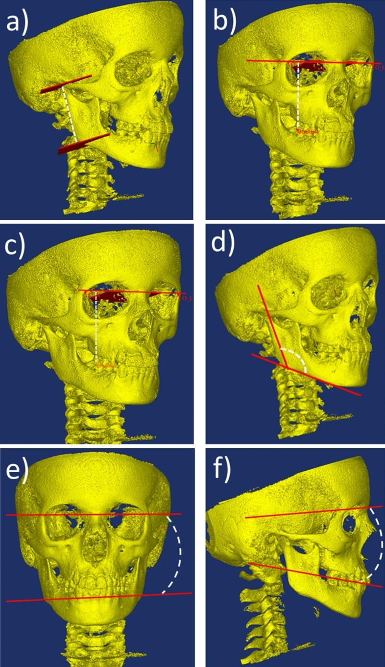 https://cdn.ncbi.nlm.nih.gov/pmc/blobs/de80/8222246/e9f6c5bf806d/41598_2021_92575_Fig1_HTML.jpg