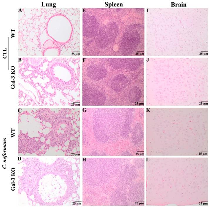 https://cdn.ncbi.nlm.nih.gov/pmc/blobs/de84/8234158/5d18f7aba04a/jof-07-00492-g001.jpg