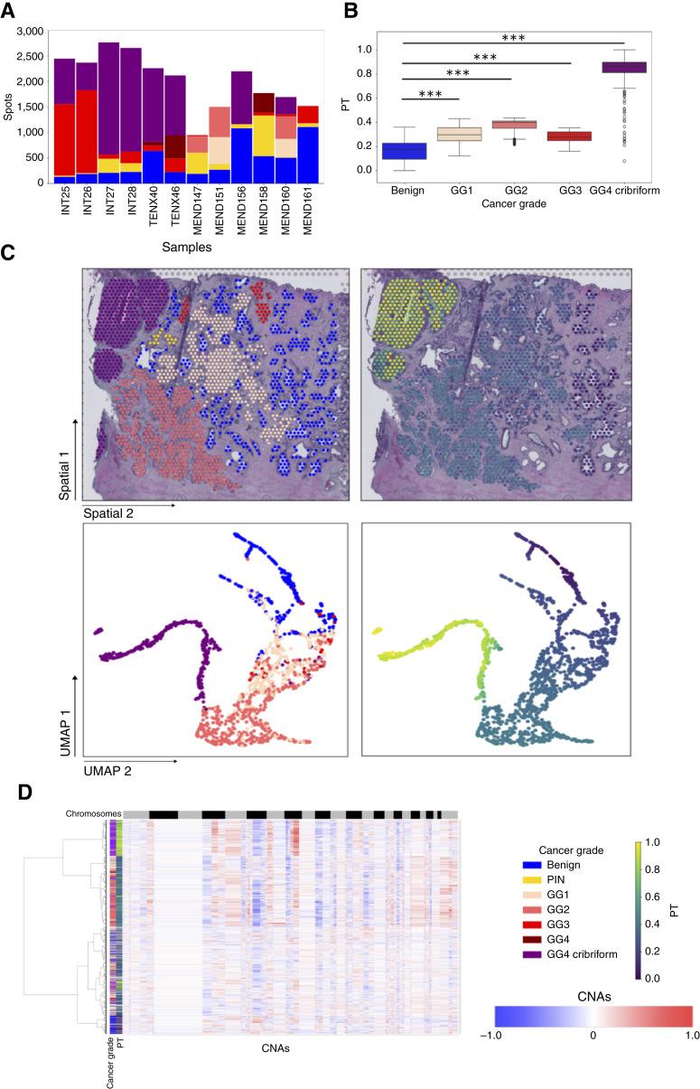 https://cdn.ncbi.nlm.nih.gov/pmc/blobs/de8e/12214874/983b07445f39/can-25-0269_f1.jpg