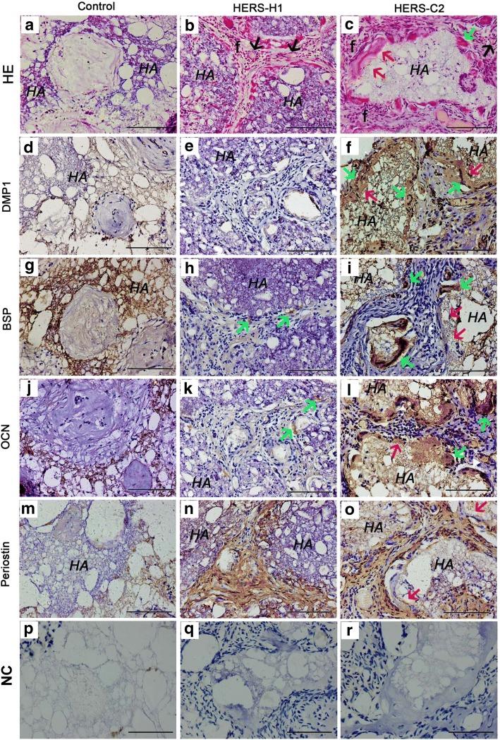 https://cdn.ncbi.nlm.nih.gov/pmc/blobs/de8e/6319004/177fceca7c80/13287_2018_1106_Fig4_HTML.jpg
