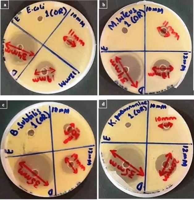 https://cdn.ncbi.nlm.nih.gov/pmc/blobs/de8e/7910555/33f17e12d69f/41598_2021_84099_Fig4_HTML.jpg