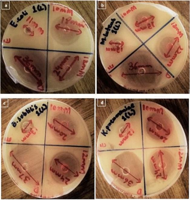 https://cdn.ncbi.nlm.nih.gov/pmc/blobs/de8e/7910555/49a2bb465d17/41598_2021_84099_Fig6_HTML.jpg