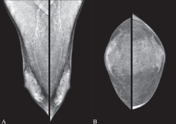 https://cdn.ncbi.nlm.nih.gov/pmc/blobs/dea0/2797738/6a16c15854cc/IJRI-19-278-g001.jpg
