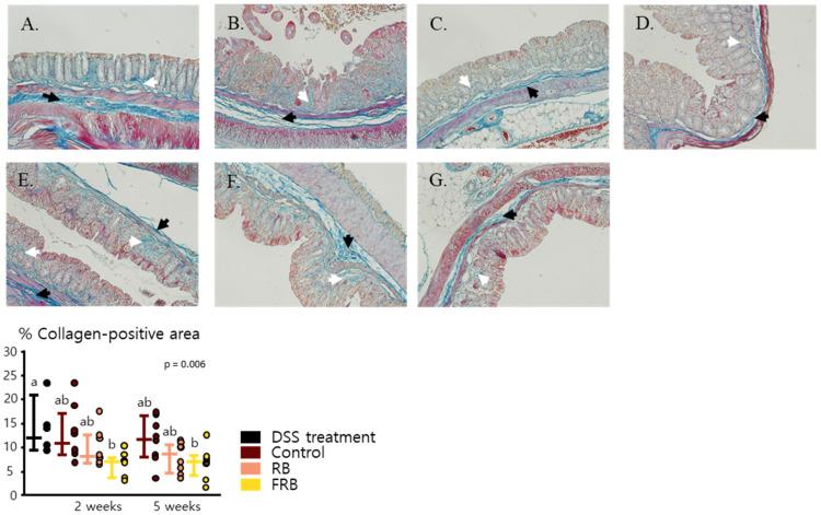 https://cdn.ncbi.nlm.nih.gov/pmc/blobs/dea3/8229226/e6406d5d5feb/nutrients-13-01869-g006.jpg