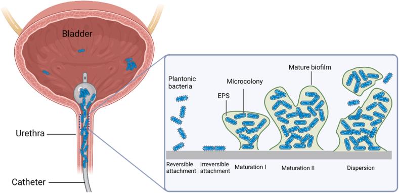 https://cdn.ncbi.nlm.nih.gov/pmc/blobs/dea5/12391287/cc35da6430c5/gr2.jpg