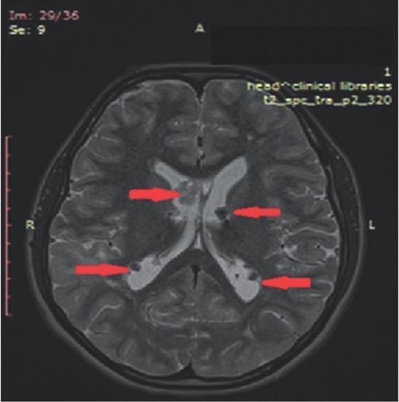 https://cdn.ncbi.nlm.nih.gov/pmc/blobs/dea5/8009567/7a283606d1fe/bjmg-23-093-g003.jpg