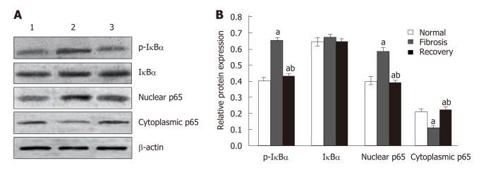 https://cdn.ncbi.nlm.nih.gov/pmc/blobs/deb1/6603813/8d4bf627a3a2/WJG-25-3044-g008.jpg