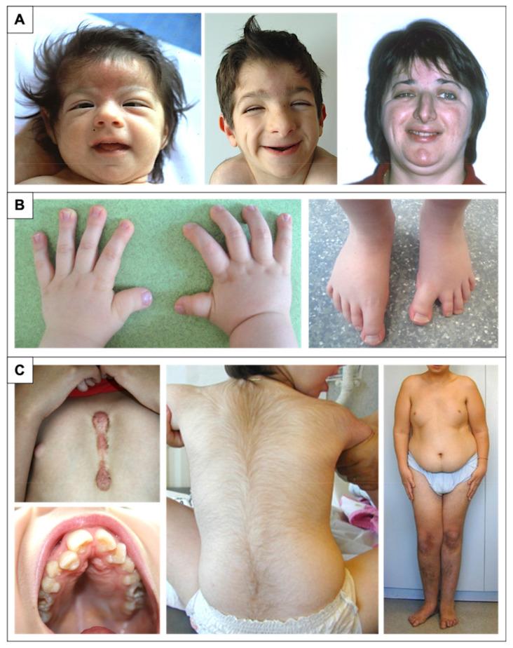 https://cdn.ncbi.nlm.nih.gov/pmc/blobs/deb3/8303114/d797bf5e30d7/genes-12-00968-g001.jpg