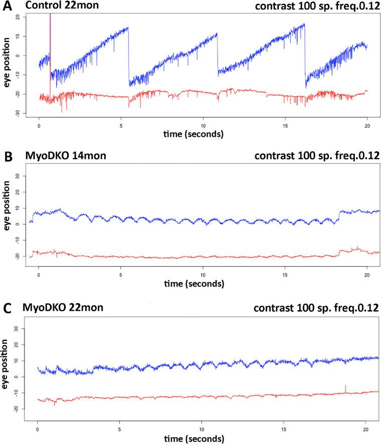 https://cdn.ncbi.nlm.nih.gov/pmc/blobs/deb4/10503593/42487a80bba6/iovs-64-12-24-f004.jpg