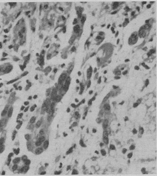 https://cdn.ncbi.nlm.nih.gov/pmc/blobs/deb5/1943661/b7625ede5b91/brmedj02350-0031-a.jpg