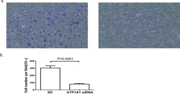 https://cdn.ncbi.nlm.nih.gov/pmc/blobs/deb6/4695053/a62683734d03/oncotarget-06-28183-g004.jpg