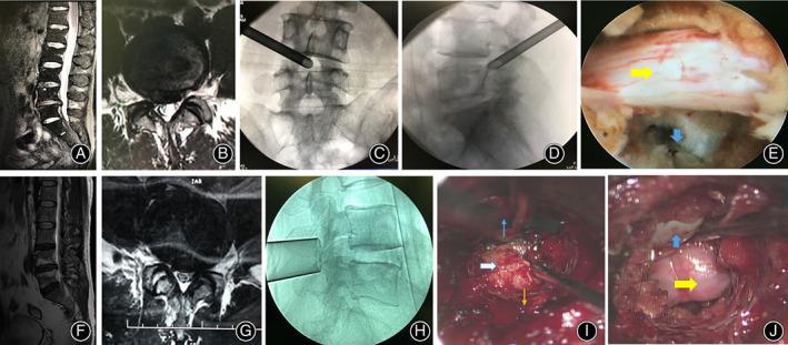 https://cdn.ncbi.nlm.nih.gov/pmc/blobs/deba/8313144/eeb8cf9fe83f/OS-13-1587-g009.jpg